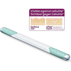 Beurer Masażer Beurer Beurer Cellulite Releazer CM 100